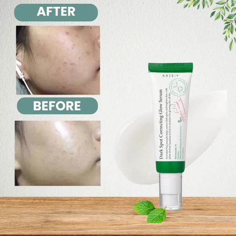 AXIS-Y Dark Spot Correcting Glow Serum | Brighten & Even Skin